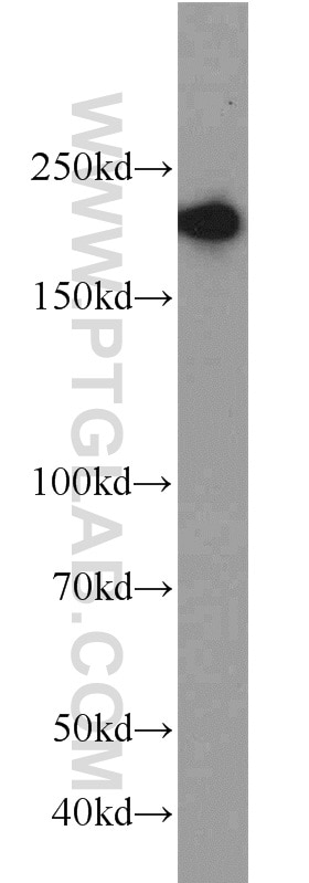 Western Blot (WB) analysis of MCF-7 cells using RB1CC1 Polyclonal antibody (10069-1-AP)