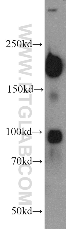 Western Blot (WB) analysis of mouse skeletal muscle tissue using RB1CC1 Polyclonal antibody (10069-1-AP)