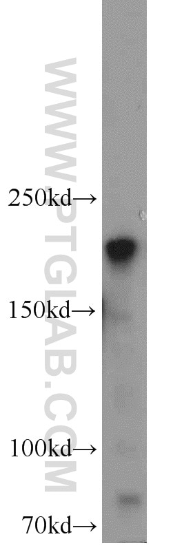 WB analysis of HeLa using 10069-1-AP