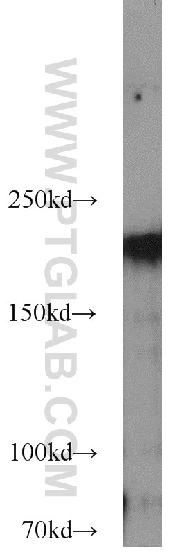 Western Blot (WB) analysis of HeLa cells using RB1CC1 Polyclonal antibody (10069-1-AP)