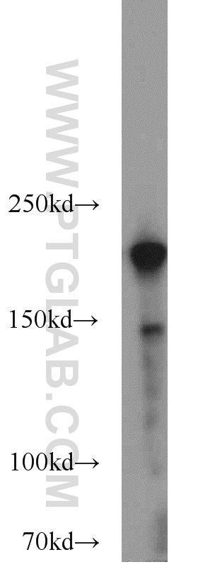 Western Blot (WB) analysis of HeLa cells using RB1CC1 Polyclonal antibody (10069-1-AP)