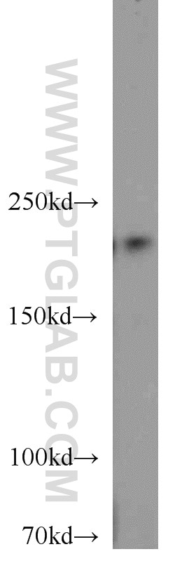 Western Blot (WB) analysis of HeLa cells using RB1CC1 Polyclonal antibody (10069-1-AP)