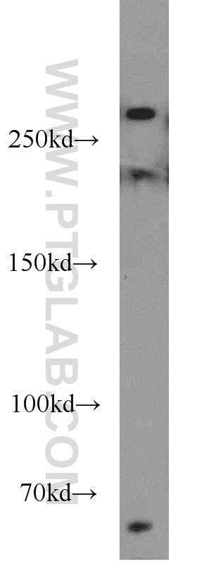 Western Blot (WB) analysis of MCF-7 cells using RB1CC1 Polyclonal antibody (10069-1-AP)