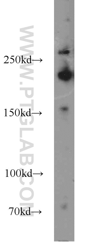 WB analysis of MCF-7 using 10069-1-AP