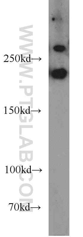 Western Blot (WB) analysis of MCF-7 cells using RB1CC1 Polyclonal antibody (10069-1-AP)