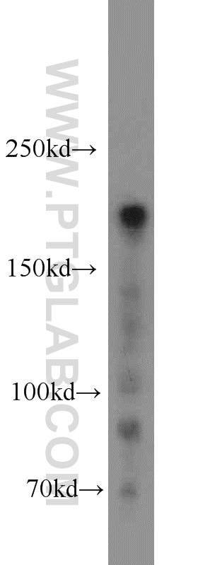 WB analysis of HeLa using 10069-1-AP