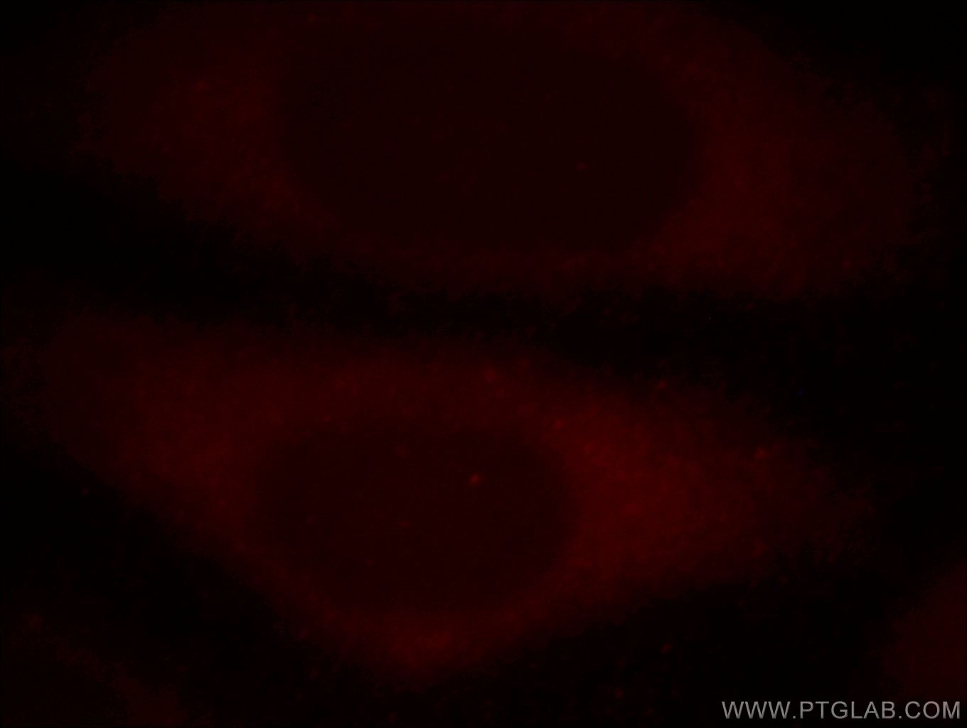 Immunofluorescence (IF) / fluorescent staining of HepG2 cells using RB1CC1 Polyclonal antibody (17250-1-AP)