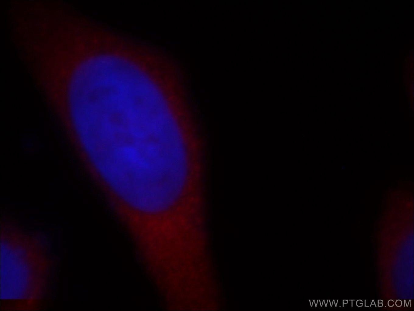 Immunofluorescence (IF) / fluorescent staining of MCF-7 cells using RB1CC1 Polyclonal antibody (17250-1-AP)