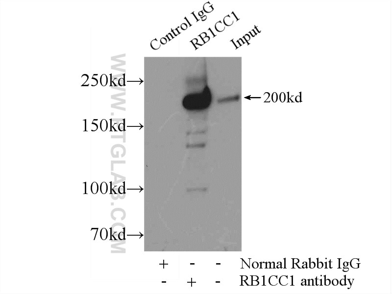 Immunoprecipitation (IP) experiment of HEK-293 cells using RB1CC1 Polyclonal antibody (17250-1-AP)