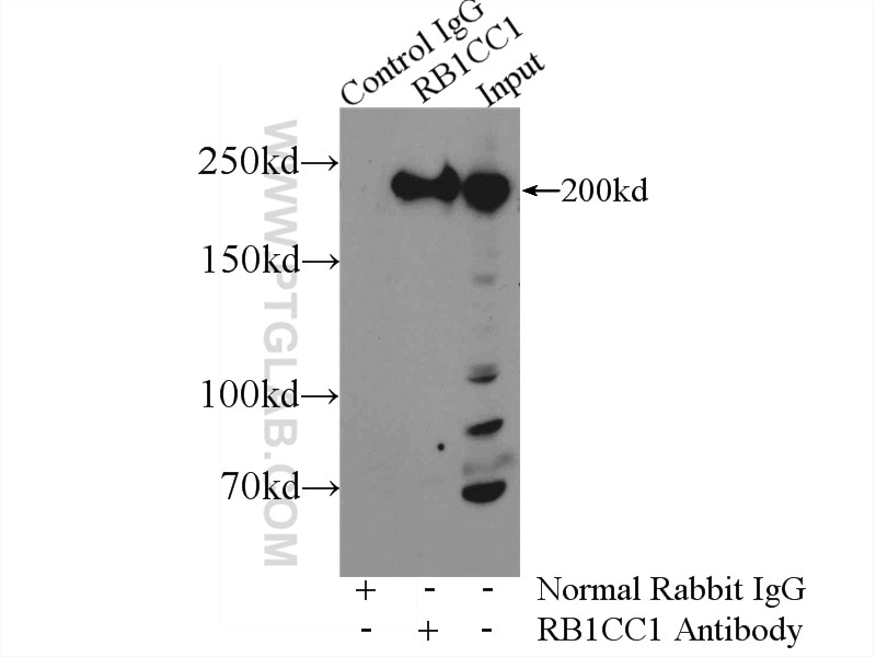 Immunoprecipitation (IP) experiment of HEK-293 cells using RB1CC1 Polyclonal antibody (17250-1-AP)