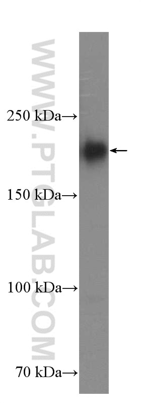 Western Blot (WB) analysis of Jurkat cells using RB1CC1 Polyclonal antibody (17250-1-AP)