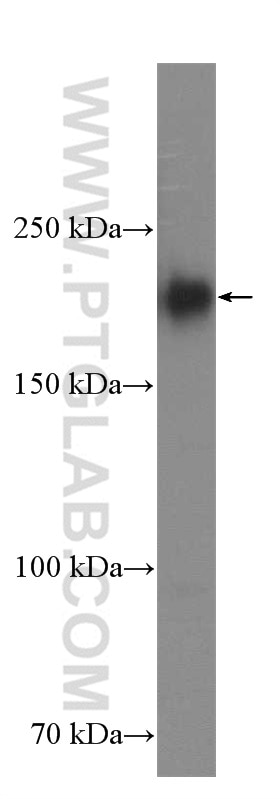 WB analysis of Jurkat using 17250-1-AP