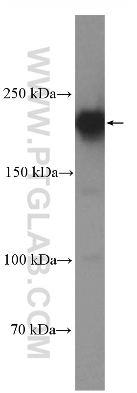 Western Blot (WB) analysis of HEK-293 cells using RB1CC1 Polyclonal antibody (17250-1-AP)