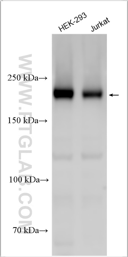Western Blot (WB) analysis of various lysates using RB1CC1 Polyclonal antibody (17250-1-AP)