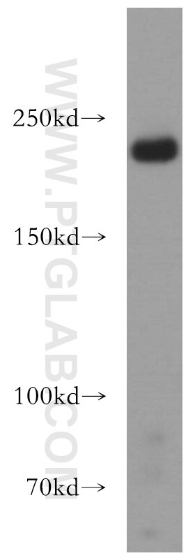 Western Blot (WB) analysis of K-562 cells using RB1CC1 Polyclonal antibody (17250-1-AP)