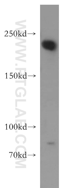 Western Blot (WB) analysis of Jurkat cells using RB1CC1 Polyclonal antibody (17250-1-AP)