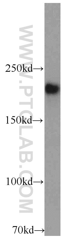 Western Blot (WB) analysis of HEK-293 cells using RB1CC1 Polyclonal antibody (17250-1-AP)