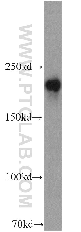 Western Blot (WB) analysis of HEK-293 cells using RB1CC1 Polyclonal antibody (17250-1-AP)