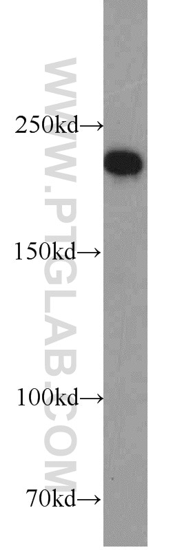 Western Blot (WB) analysis of MCF-7 cells using RB1CC1 Polyclonal antibody (17250-1-AP)