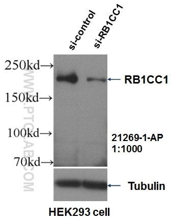 Western Blot (WB) analysis of HEK-293 cells using RB1CC1 Polyclonal antibody (21269-1-AP)