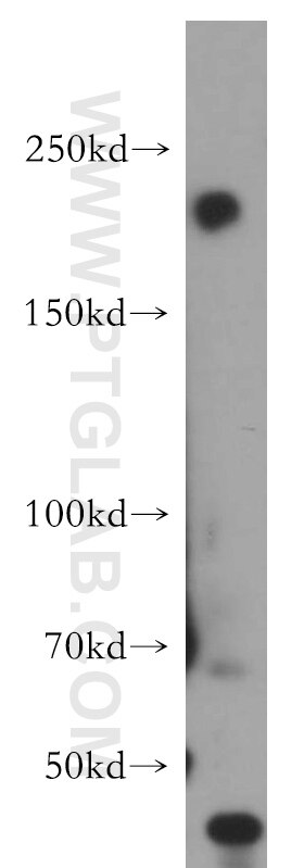 Western Blot (WB) analysis of MCF-7 cells using RB1CC1 Polyclonal antibody (21269-1-AP)