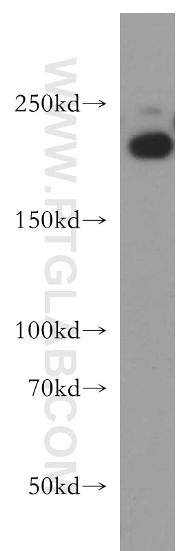 Western Blot (WB) analysis of HEK-293 cells using RB1CC1 Polyclonal antibody (21269-1-AP)