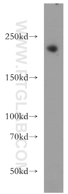 Western Blot (WB) analysis of HeLa cells using RB1CC1 Polyclonal antibody (21269-1-AP)