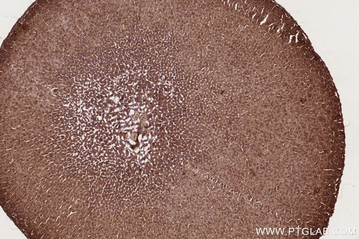IHC staining of mouse adrenal gland using 84757-3-RR Immunohistochemistry (IHC) staining of mouse adrenal gland tissue using RB1CC1 Recombinant monoclonal antibody (84757-3-RR)