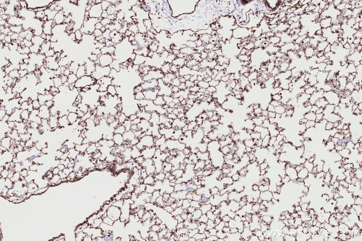 IHC staining of mouse lung using 84757-3-RR Immunohistochemistry (IHC) staining of mouse lung tissue using RB1CC1 Recombinant monoclonal antibody (84757-3-RR)