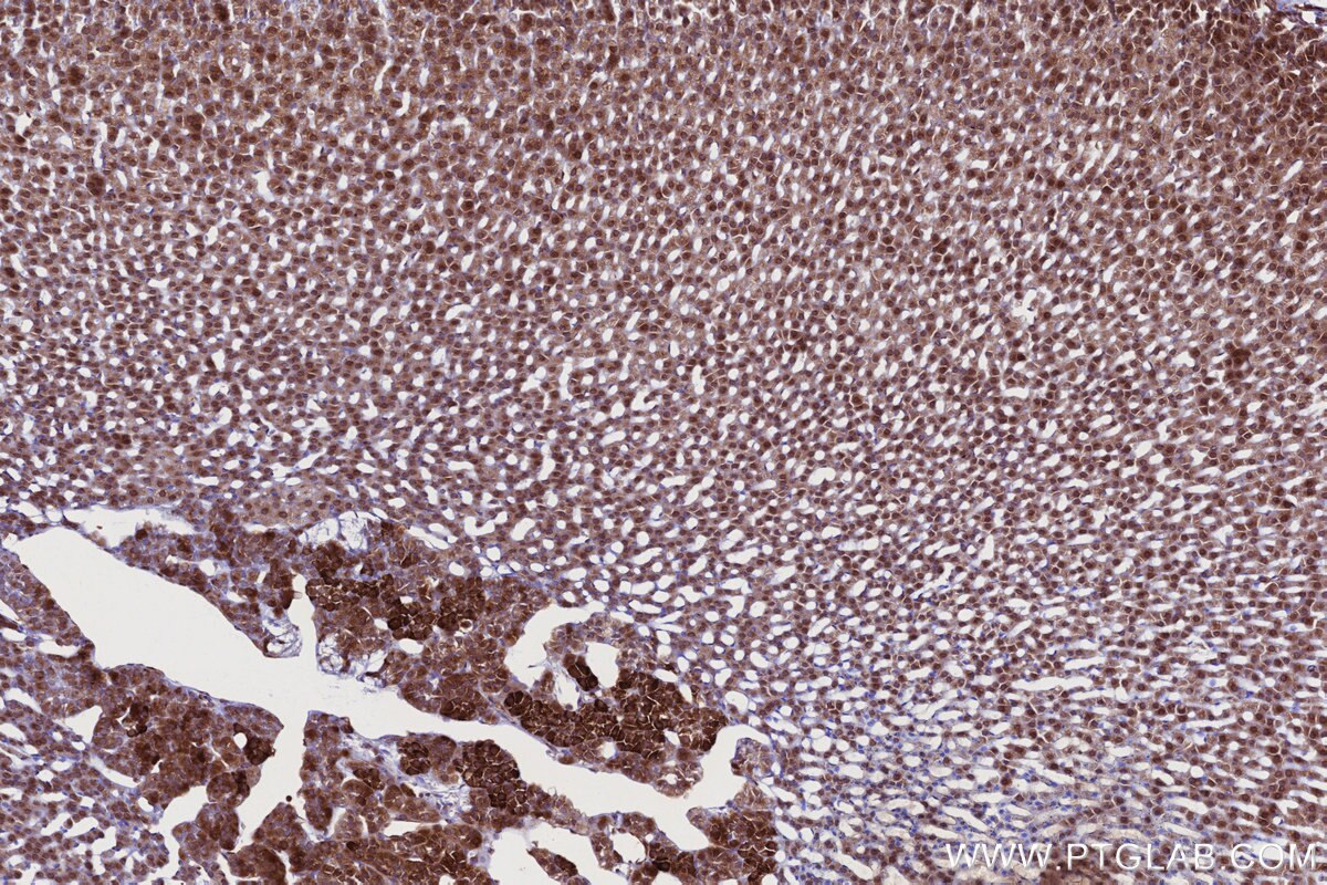 IHC staining of rat adrenal gland using 84757-3-RR Immunohistochemistry (IHC) staining of rat adrenal gland tissue using RB1CC1 Recombinant monoclonal antibody (84757-3-RR)
