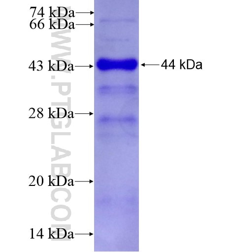 RB1CC1 fusion protein Ag10508 SDS-PAGE