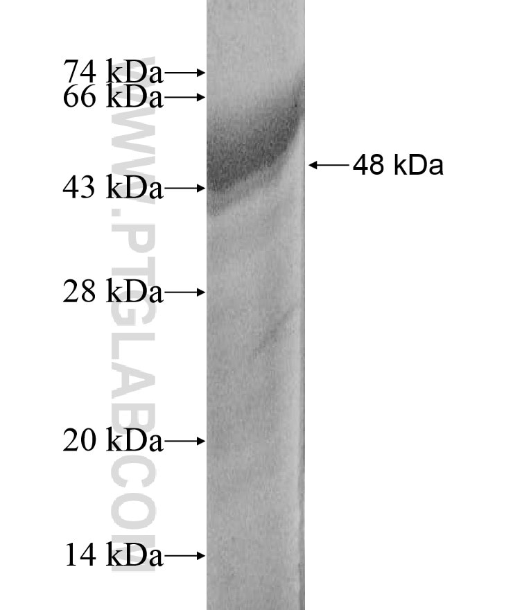 RB1CC1 fusion protein Ag17208 SDS-PAGE