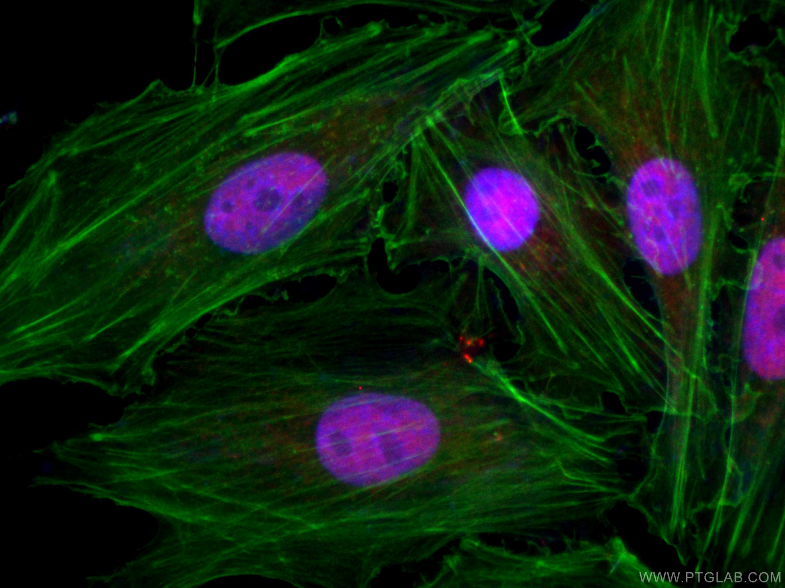 Immunofluorescence (IF) / fluorescent staining of A549 cells using CoraLite®594-conjugated RBAP48 Monoclonal antibody (CL594-66060)