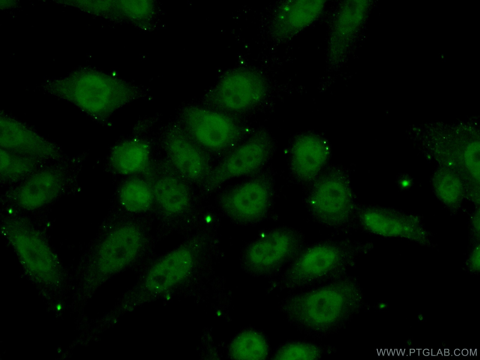 Immunofluorescence (IF) / fluorescent staining of HeLa cells using RBAP48 Polyclonal antibody (14557-1-AP)