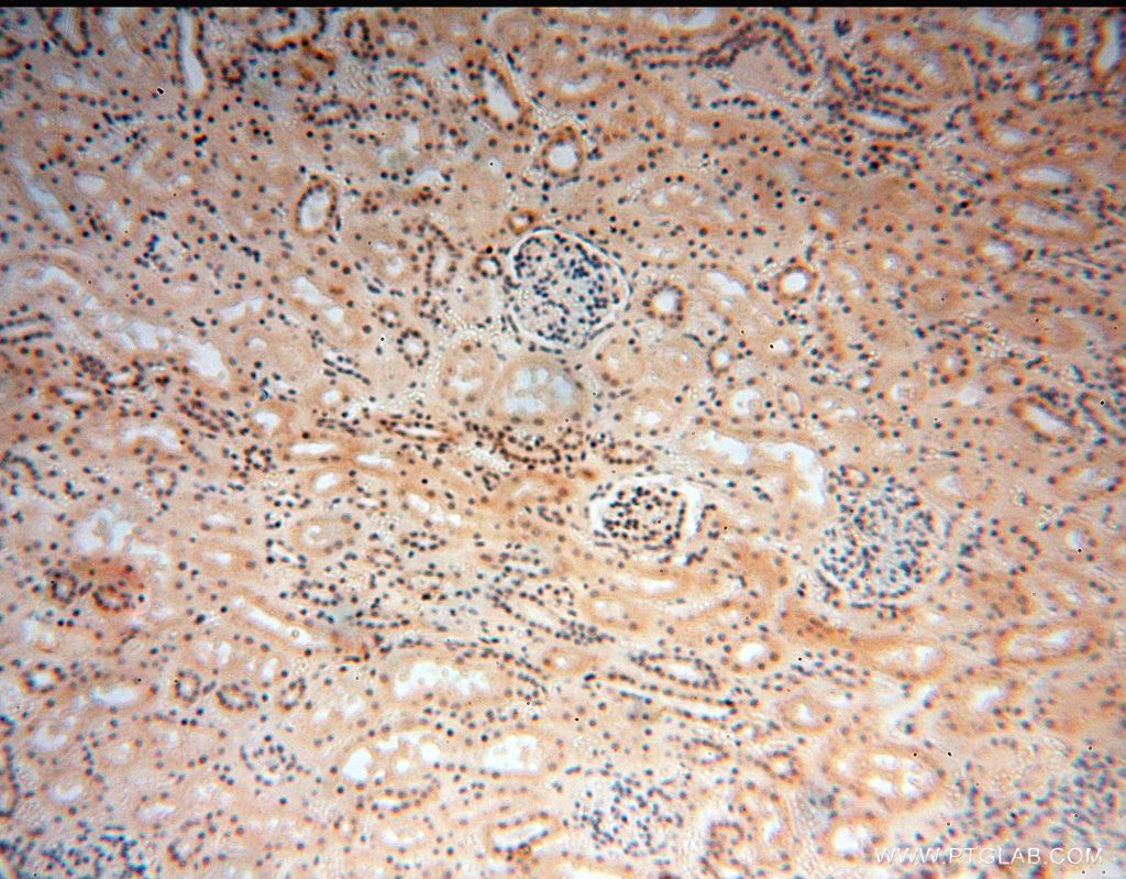 Immunohistochemistry (IHC) staining of human kidney tissue using RBAP48 Polyclonal antibody (14557-1-AP)