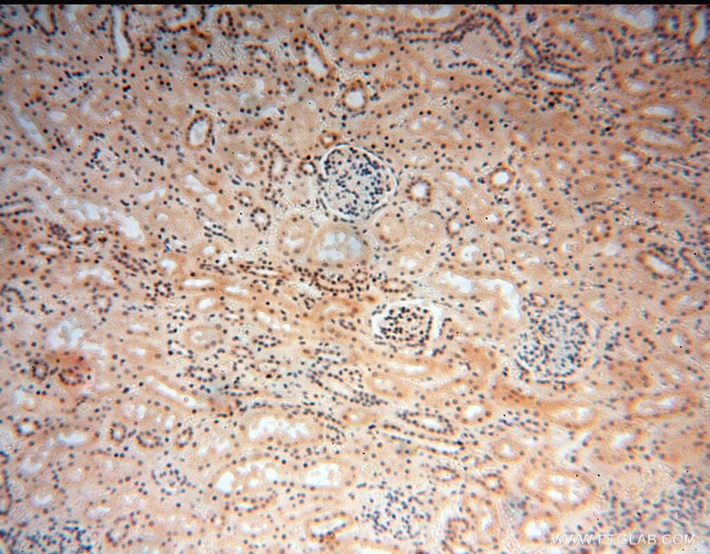 IHC staining of human kidney using 14557-1-AP