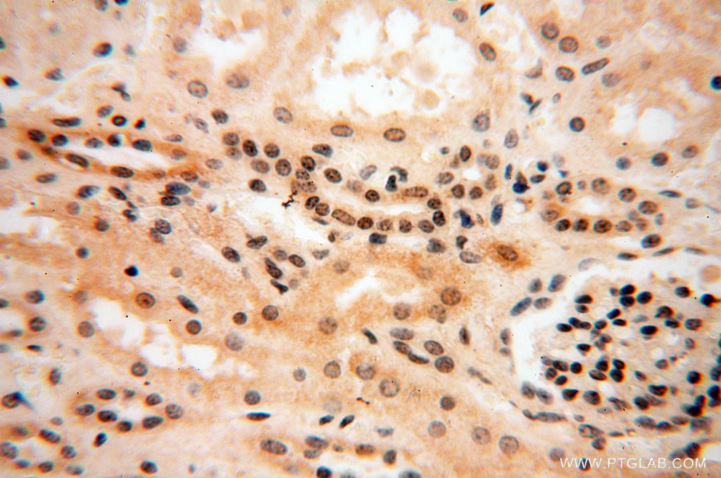 Immunohistochemistry (IHC) staining of human kidney tissue using RBAP48 Polyclonal antibody (14557-1-AP)