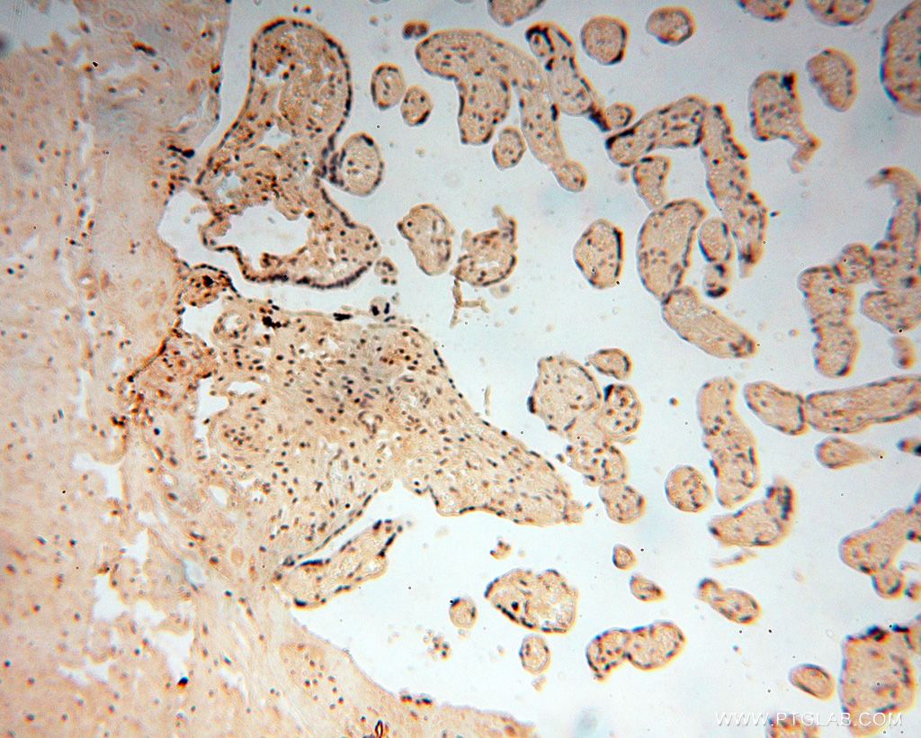 IHC staining of human placenta using 14557-1-AP