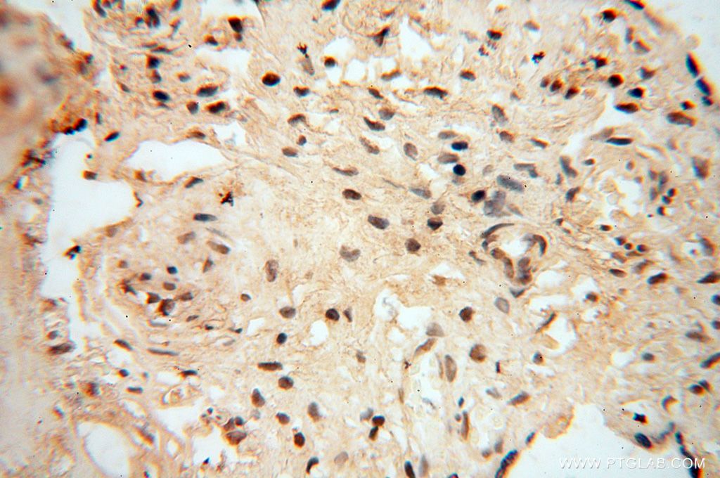 Immunohistochemistry (IHC) staining of human placenta tissue using RBAP48 Polyclonal antibody (14557-1-AP)