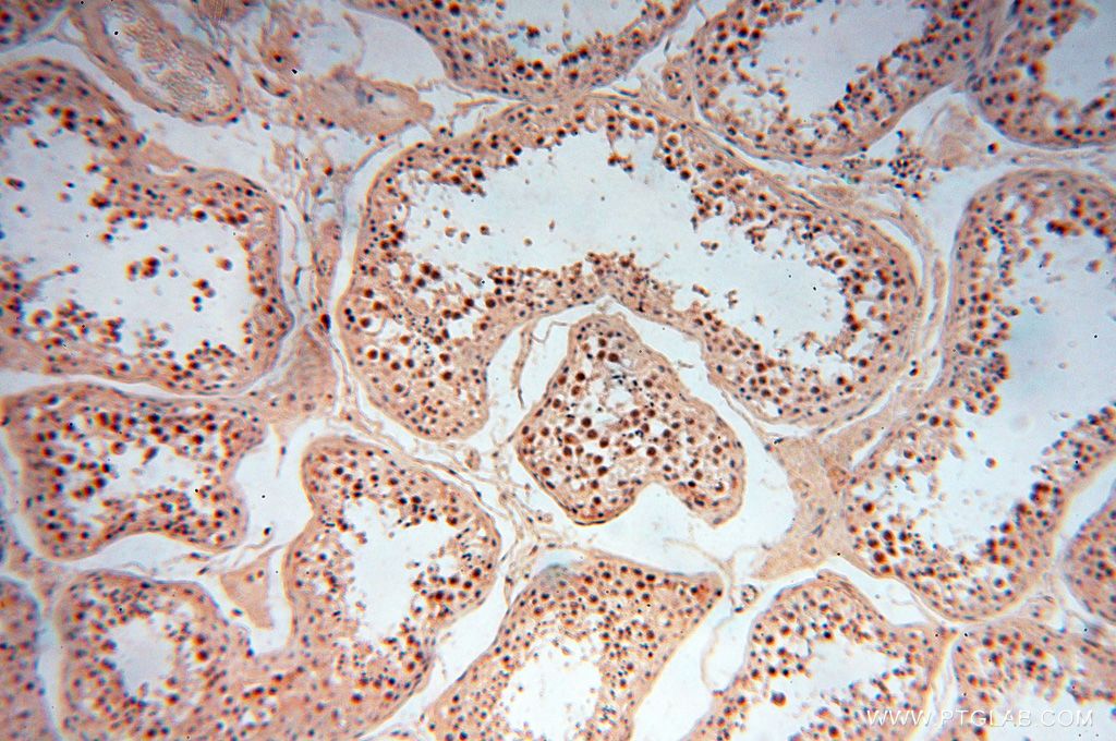 Immunohistochemistry (IHC) staining of human testis tissue using RBAP48 Polyclonal antibody (14557-1-AP)