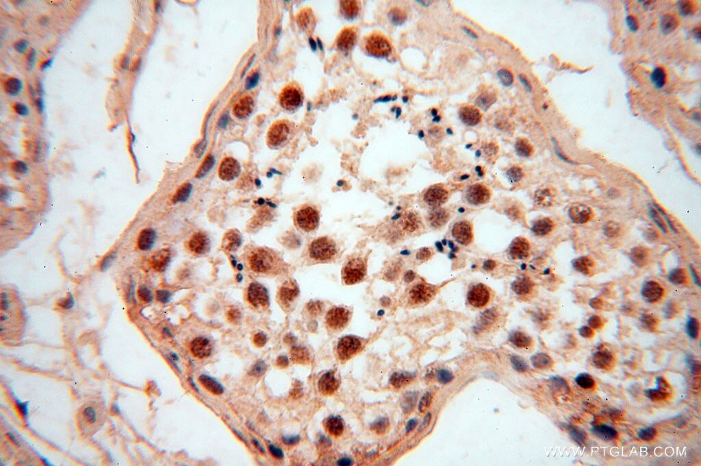Immunohistochemistry (IHC) staining of human testis tissue using RBAP48 Polyclonal antibody (14557-1-AP)