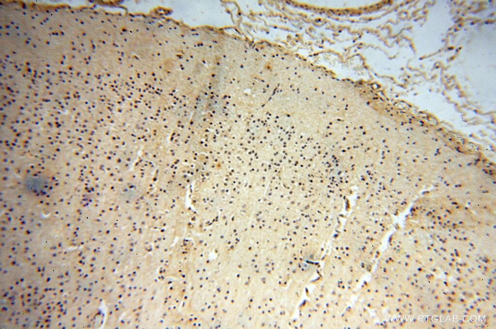 Immunohistochemistry (IHC) staining of human brain tissue using RBAP48 Polyclonal antibody (14557-1-AP)