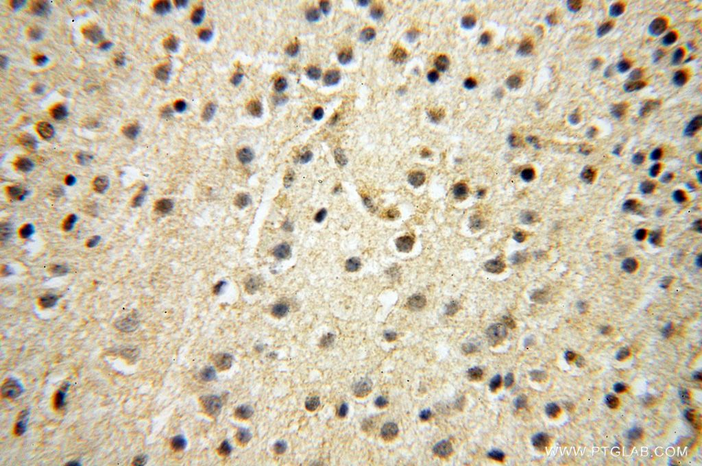 Immunohistochemistry (IHC) staining of human brain tissue using RBAP48 Polyclonal antibody (14557-1-AP)