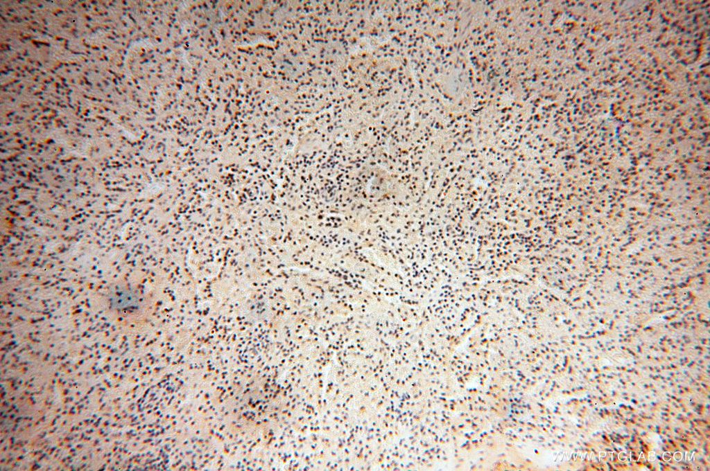 Immunohistochemistry (IHC) staining of human spleen tissue using RBAP48 Polyclonal antibody (14557-1-AP)