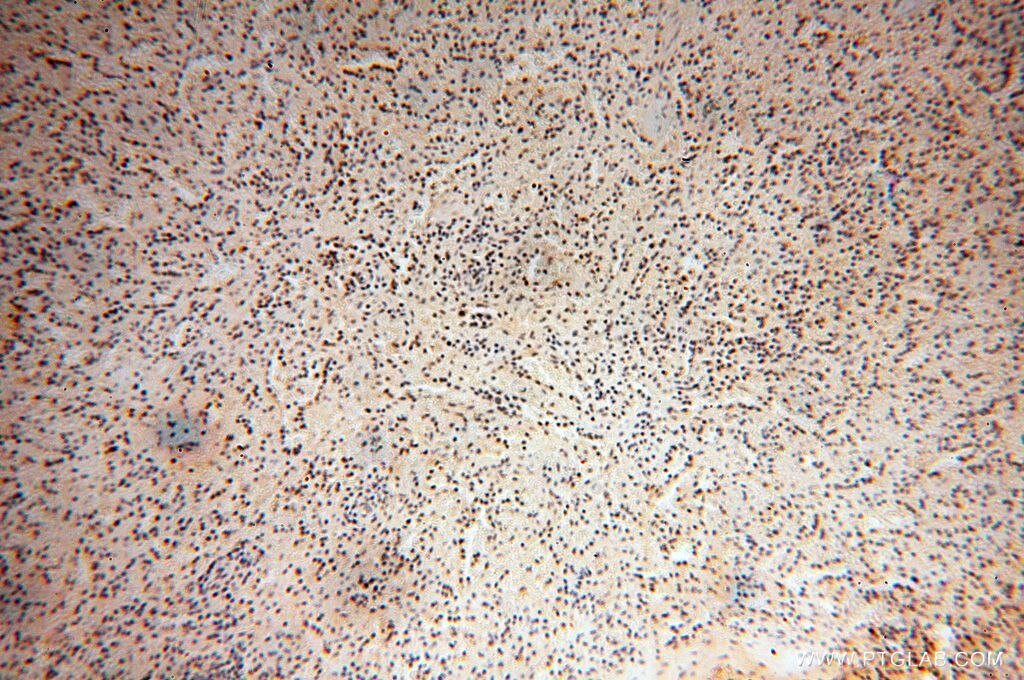 Immunohistochemistry (IHC) staining of human spleen tissue using RBAP48 Polyclonal antibody (14557-1-AP)