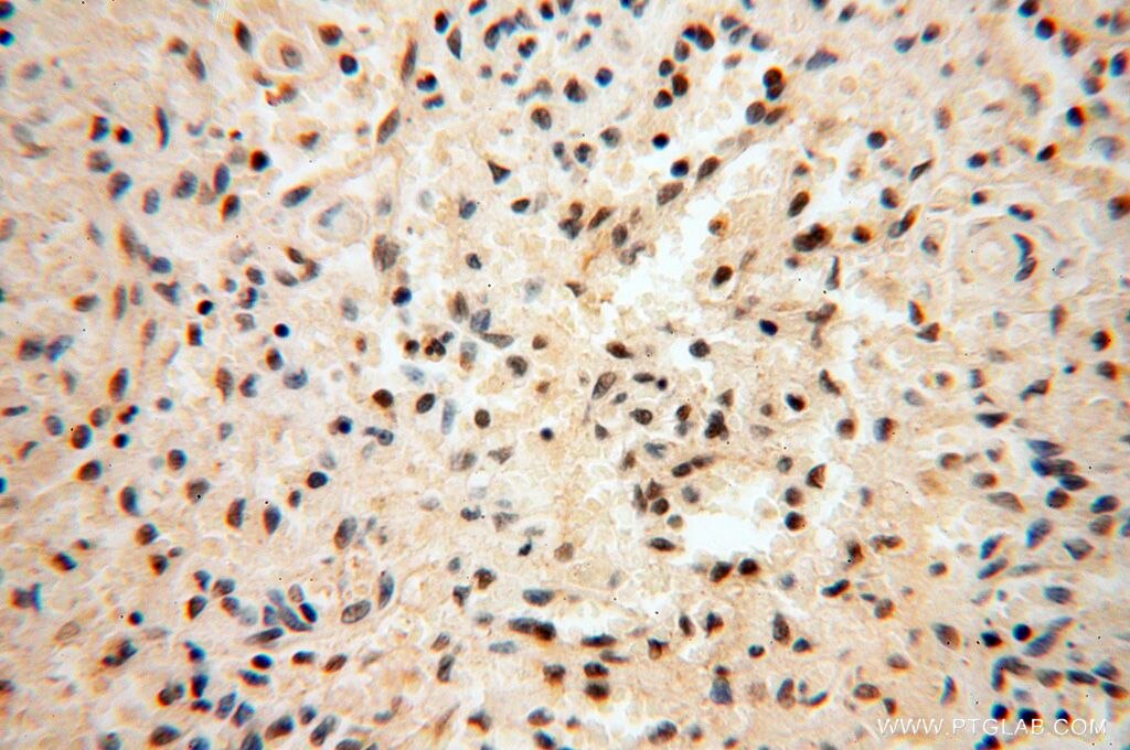 Immunohistochemistry (IHC) staining of human spleen tissue using RBAP48 Polyclonal antibody (14557-1-AP)