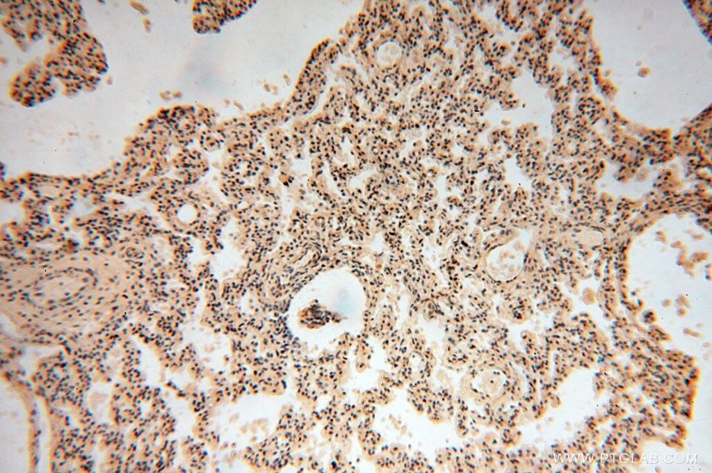 Immunohistochemistry (IHC) staining of human lung tissue using RBAP48 Polyclonal antibody (14557-1-AP)