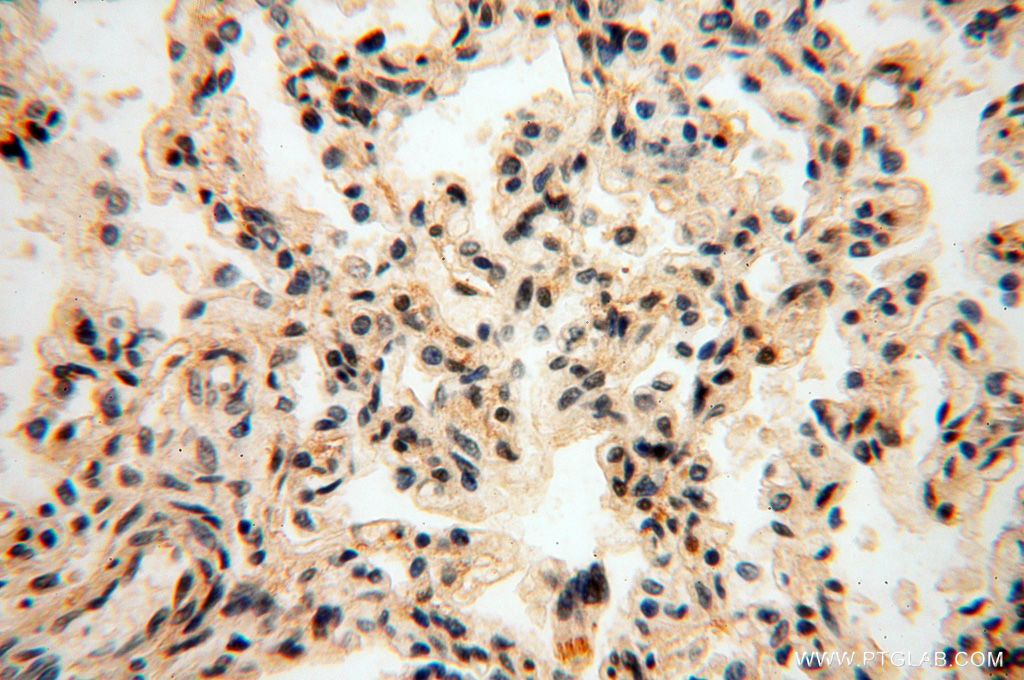 IHC staining of human lung using 14557-1-AP