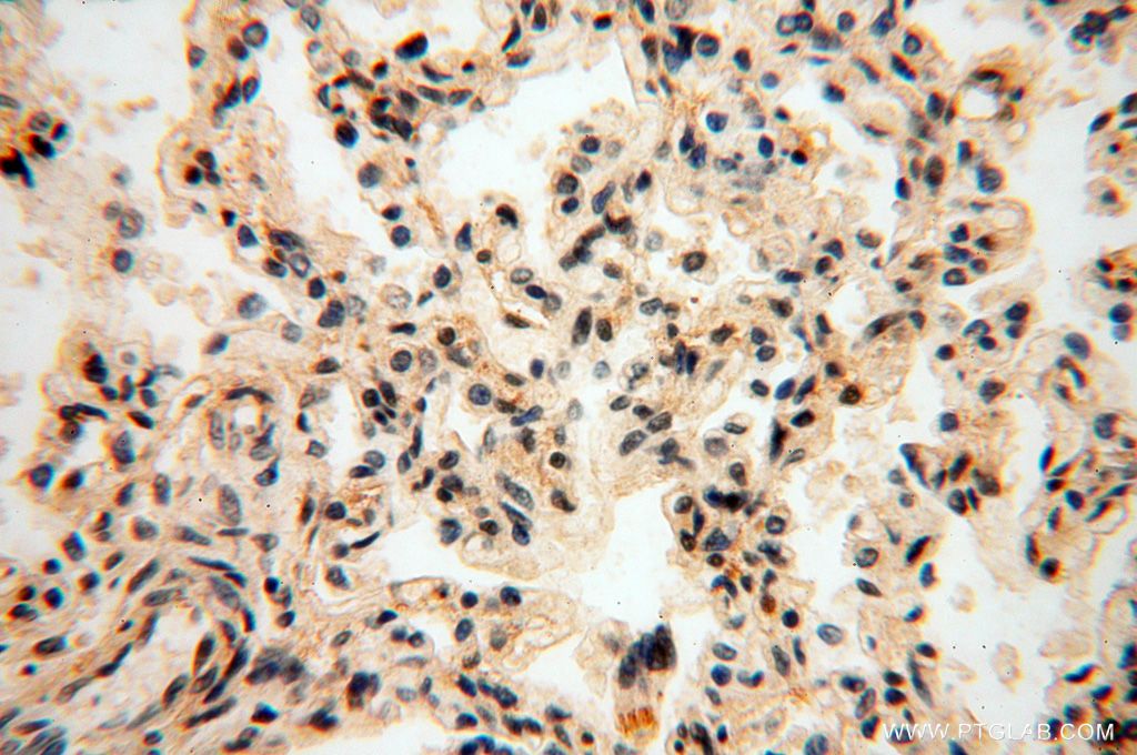 Immunohistochemistry (IHC) staining of human lung tissue using RBAP48 Polyclonal antibody (14557-1-AP)