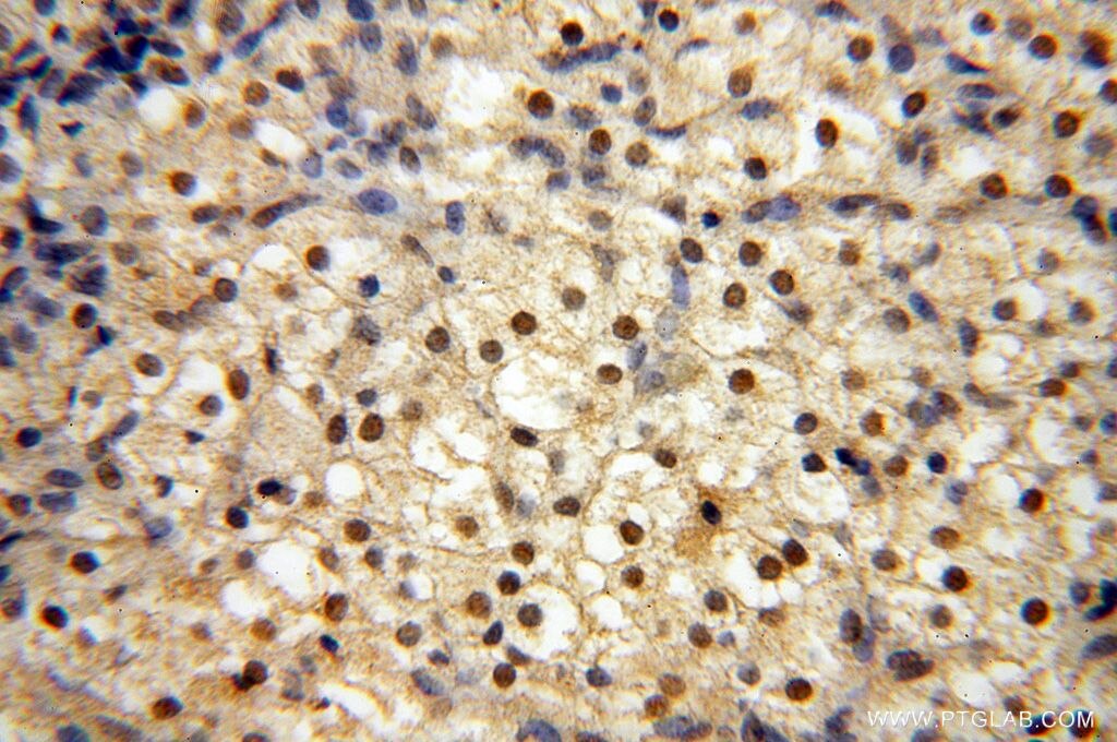 Immunohistochemistry (IHC) staining of human ovary tissue using RBAP48 Polyclonal antibody (14557-1-AP)